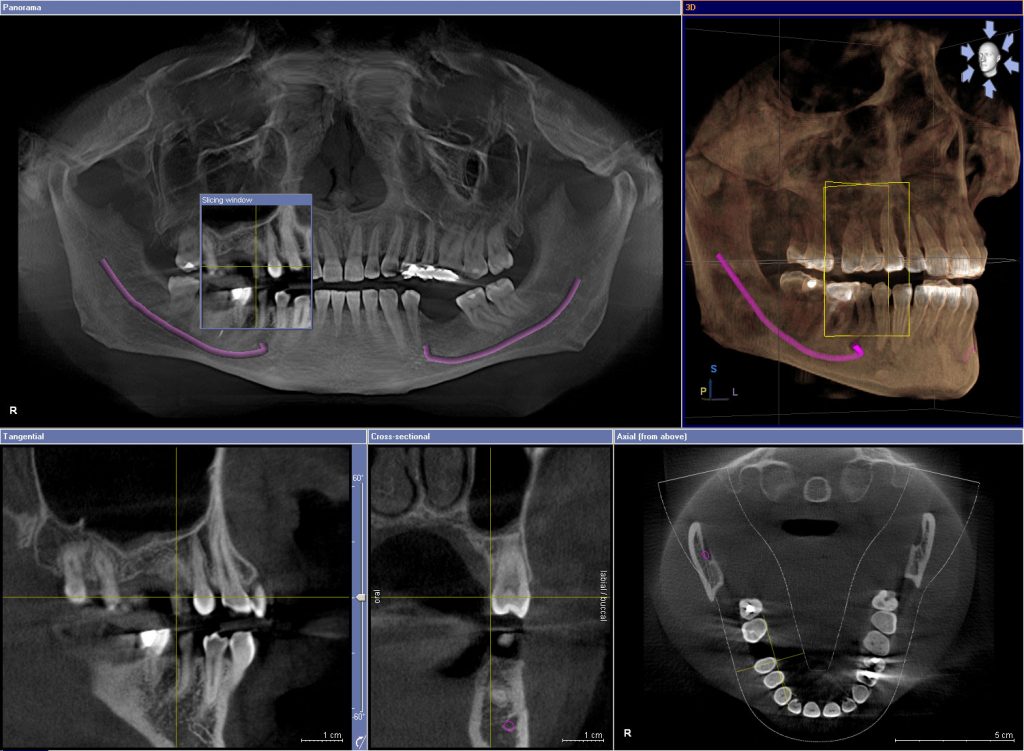 cone-beam-imaging-dr-brough-family-cosmetic-dentistry